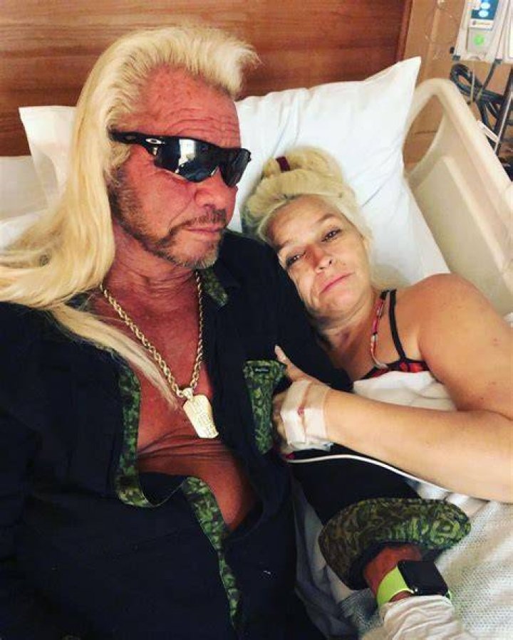 Beth Chapman Cancer Updates, Net Worth, Husband, Married, Divorce, Bio, Now